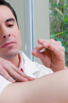 Acupuncturist applying needles on a personŽs back