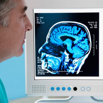 Doctor examining MRI report of brain on a computer screen