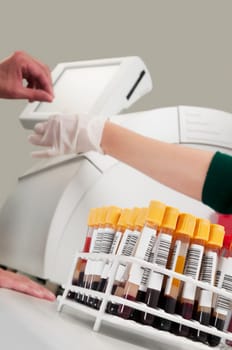 Lab technician testing a blood samples in a laboratory