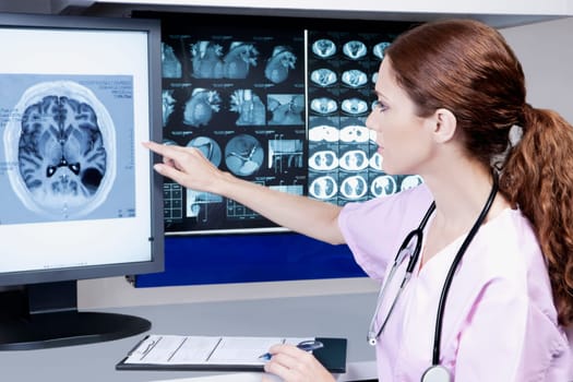 Female doctor examining MRI report