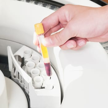 Lab technician putting a blood sample in the laboratory freezer