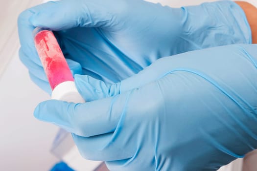 Doctor holding a medical sample in a laboratory