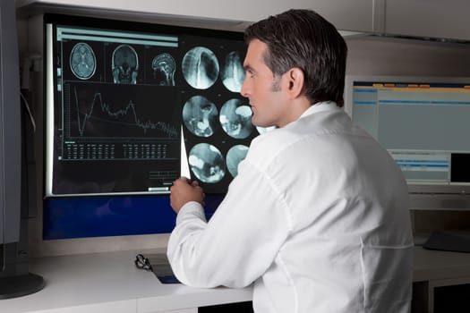 Doctor examining MRI report