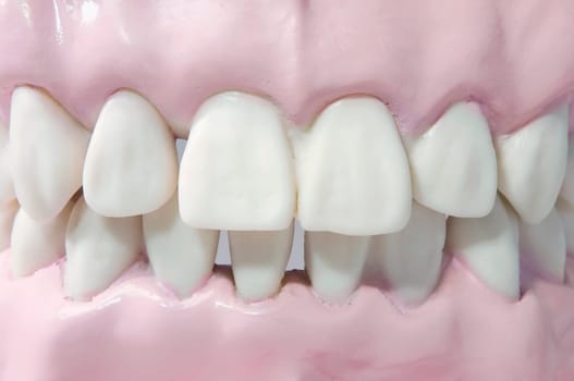 Close_up of a set of dentures