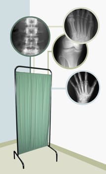 X-Ray images over a hospital screen