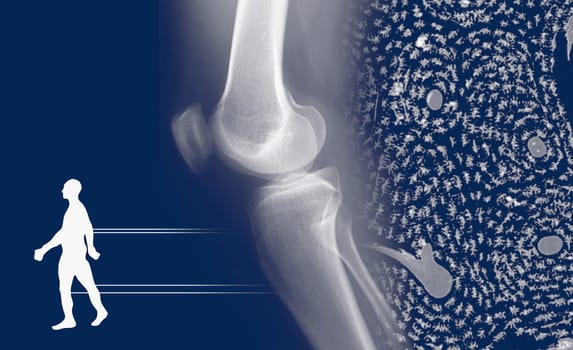 Human joint