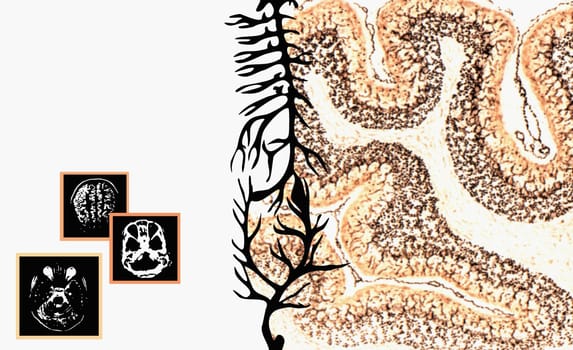 The human spine and diagrams of human organs