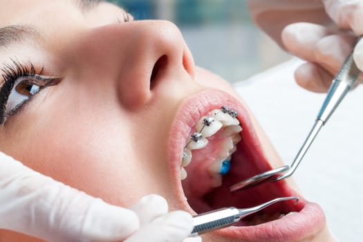 Dentist hands working on young teen patient with dental braces.