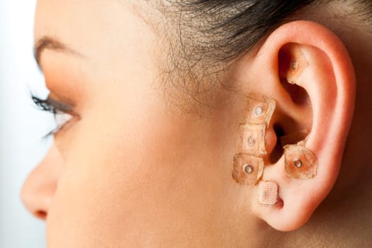 Macro close up of auriculotherapy on female ear.