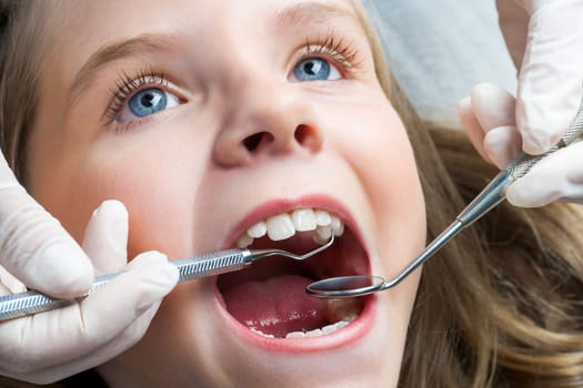 Macro close up portrait of Little girl with open mouth having dental check up.