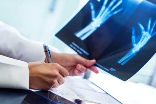 Close up of young doctor holding x-ray and writing down prescription at desk.