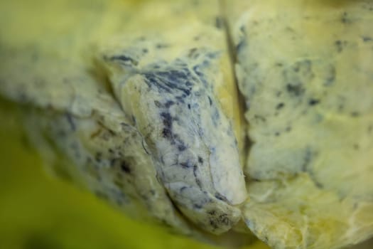 Close-up of lung of a dead smoker with black spots. Forensic photo of human organ in pathological condition after inhaling smoke and polluted air. Smoking kills.