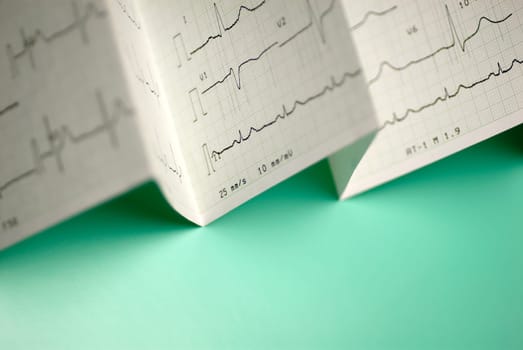 Close_up of an electrocardiogram report