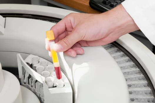 Lab technician putting a blood sample in the laboratory freezer