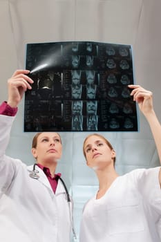 Doctors examining an X_Ray report