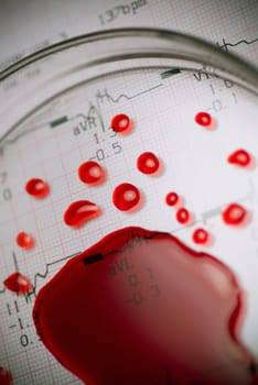 Close_up of a magnifying glass on blood cells