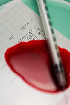 Close_up of a syringe with blood on an electrocardiogram report