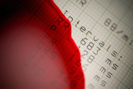 Close_up of blood split on an electrocardiogram report