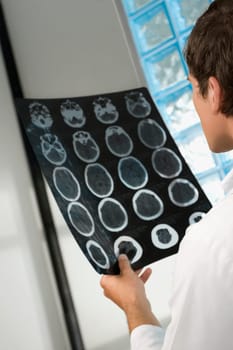Side profile of a male doctor examining an X_Ray report