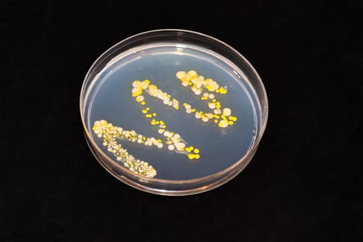 An agar dish with bacteria and fungi colonies against black.