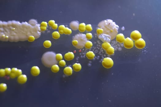 Macro view of bacteria and baker yeast colonies.