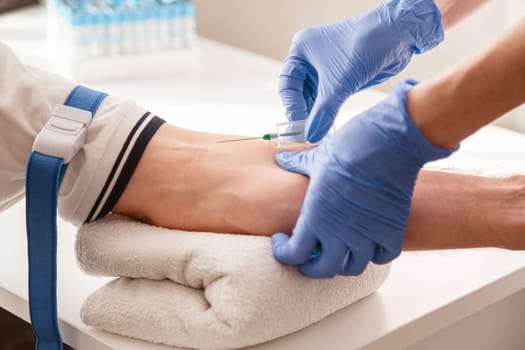 The nurse draws blood from a vein for test. Blood chemistry