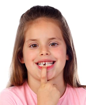 Friendly gril showing her broken teeth isolated on a white background