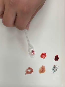 Medical doctor performing a quick blood group determination by using blood type testing kit with anti A and B antibodies on a white card. High quality photo