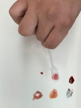 Medical doctor performing a quick blood group determination by using blood type testing kit with anti A and B antibodies on a white card. High quality photo