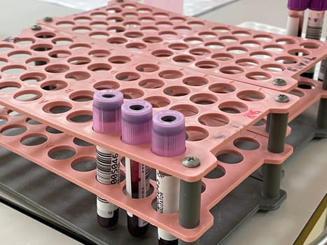 Laboratory interior, test lab, blood samples from patients with viral pneumonia to be tested for presence of nucleic acids for SARS-CoV-2 and flu virus and specific antibodies against the viruses. High quality photo
