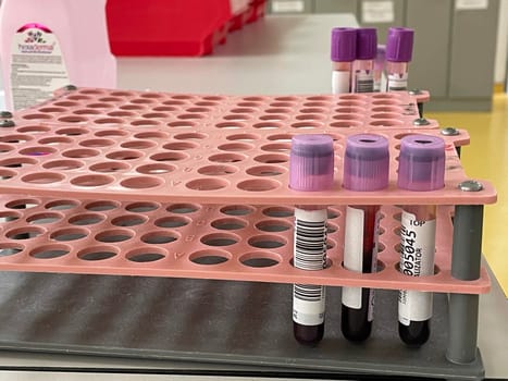 Laboratory interior, test lab, blood samples from patients with viral pneumonia to be tested for presence of nucleic acids for SARS-CoV-2 and flu virus and specific antibodies against the viruses. High quality photo