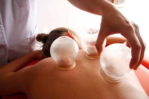 Acupunture cupping is a  Chinese Medicine Procedure