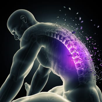 3D render of a male figure leaning over with spine highlighted and shattering