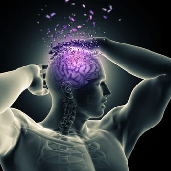 3D render of a male figure holding head with brain shattering depicting mental health issues