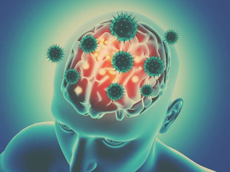 3D render of a male figure with brain being attached by virus cells