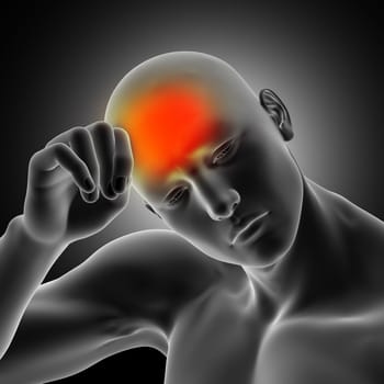3D render of a male medical figure holding head in pain