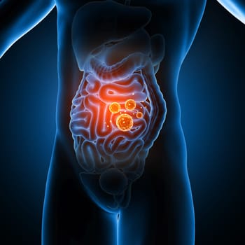 3D render of a male medical figure showing virus cells in the guts