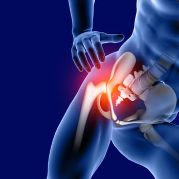 3D render of a male medical figure with hip bone highlighted