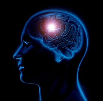 3D render of a male medical figure with brain highlighted