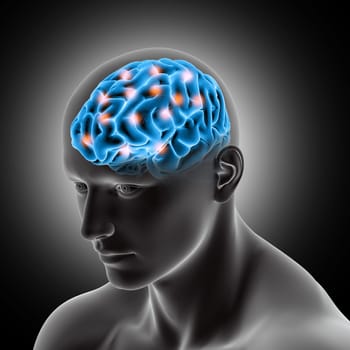 3D render of a male medical figure showing brain with highlights