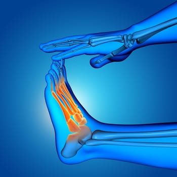 3D render of a male medical figure with close up of foot with bones highlighted