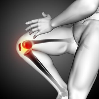 3D render of a male medical figure with close up of knee bone