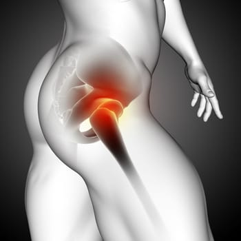 3D render of a male medical figure with close up of hip bone