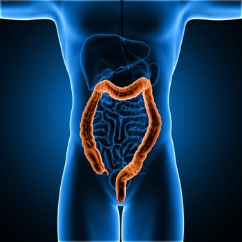 3D render of a male medical figure with colon highlighted