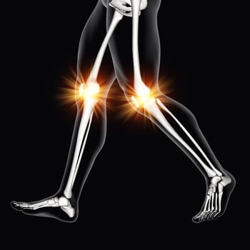 3D render of a male medical figure with knee bones highlighted
