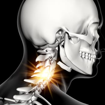 3D render of a male medical figure with neck bones highlighted