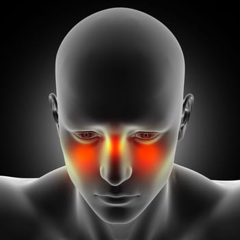 3D render of a male medical figure with sinus pain highlighted