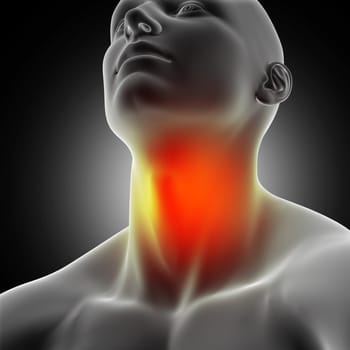 3D render of a male medical figure with sore throat