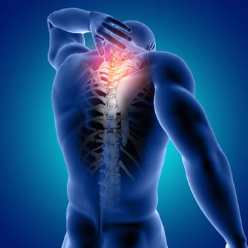 3D render of a male medical figure with top of spine highlighted