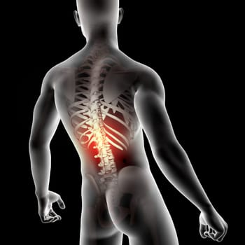 3D render of a male medical figure with spine highlighted